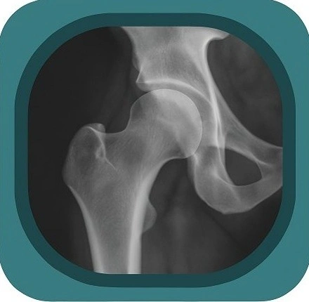X ray hip  anatomy icon
